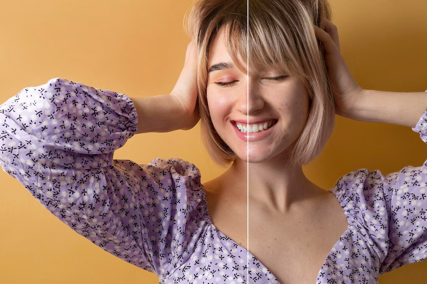  Cervical Cancer Before-After